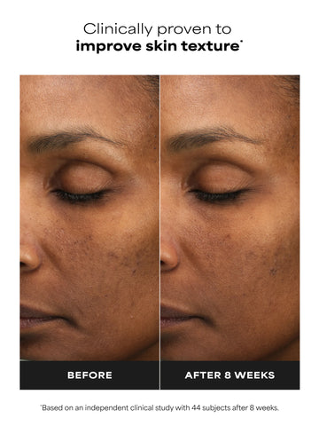 6% Mandelic Acid + 2% Lactic Acid Liquid Exfoliant