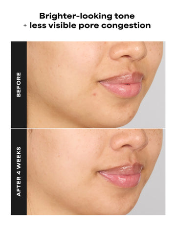 4% BHA Advanced Exfoliating Serum Toner