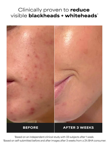 2% BHA Liquid Exfoliant
